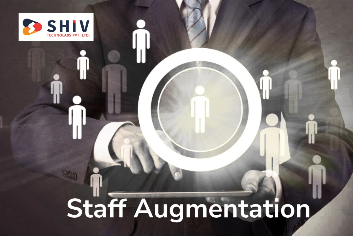 5 Benefits of Staff Augmentation That Save Time